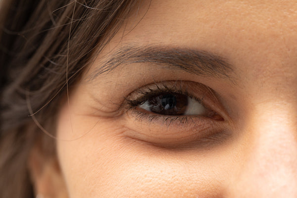 Doctor-Approved Ways to Treat Under-Eye Bags